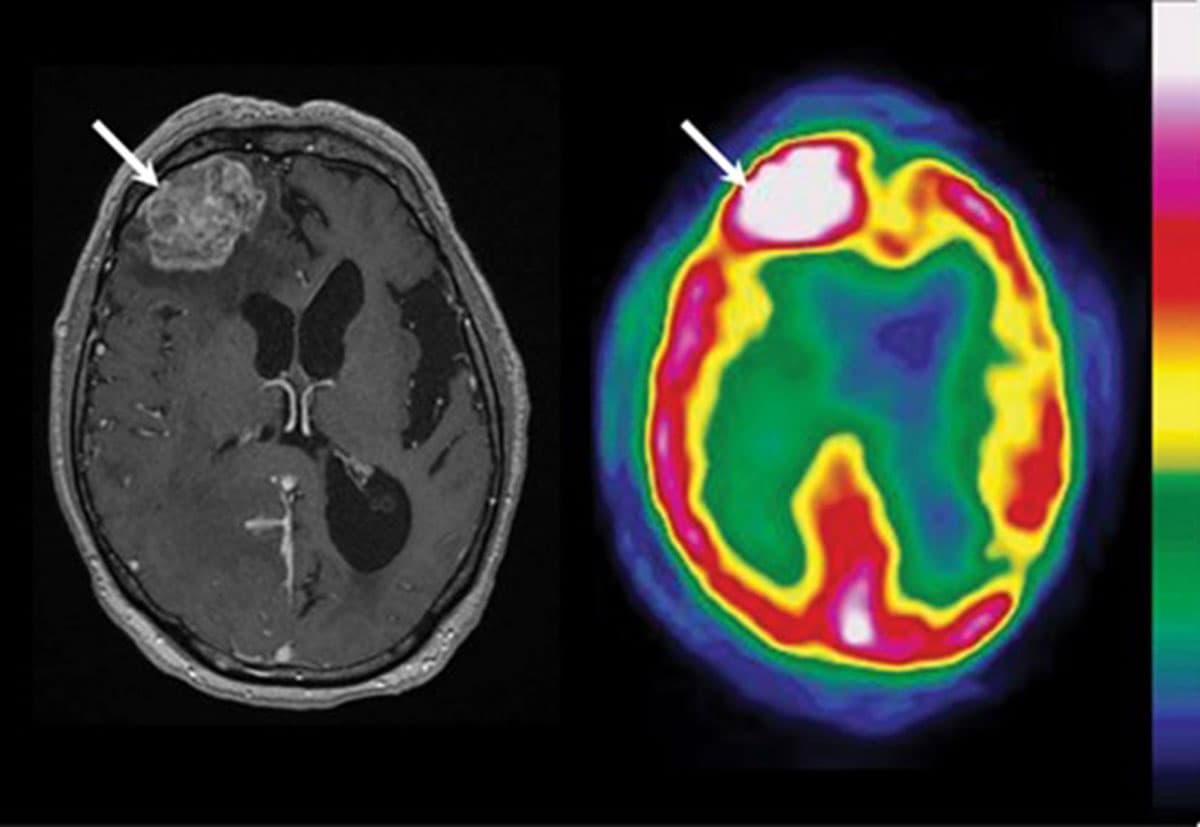 1-NEW RFP For Neuroimaging Studies